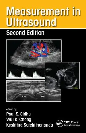 Sidhu / Chong / Satchithananda |  Measurement in Ultrasound | Buch |  Sack Fachmedien