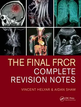 Helyar / Shaw |  The Final FRCR | Buch |  Sack Fachmedien