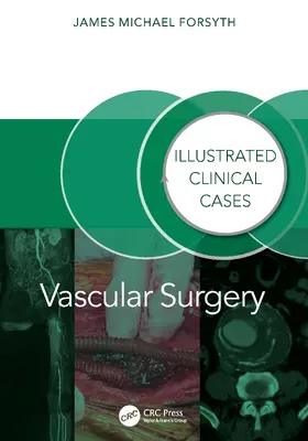 Forsyth |  Vascular Surgery: | Buch |  Sack Fachmedien