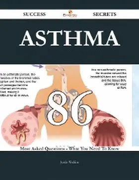 Watkins |  Asthma 86 Success Secrets - 86 Most Asked Questions On Asthma - What You Need To Know | eBook | Sack Fachmedien