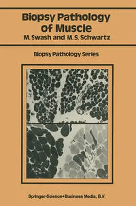 Swash / Schwartz |  Biopsy pathology of muscle | eBook | Sack Fachmedien