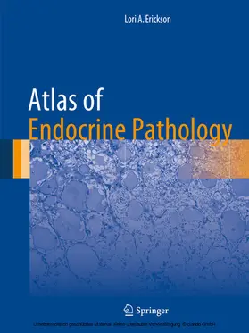 Erickson |  Atlas of Endocrine Pathology | eBook | Sack Fachmedien