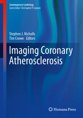 Nicholls / Crowe | Imaging Coronary Atherosclerosis | E-Book | www2.sack.de