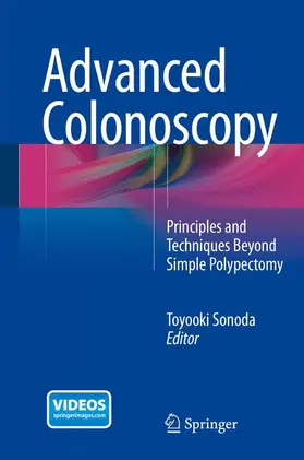 Sonoda |  Advanced Colonoscopy | Buch |  Sack Fachmedien