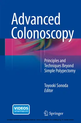 Sonoda | Advanced Colonoscopy | E-Book | sack.de