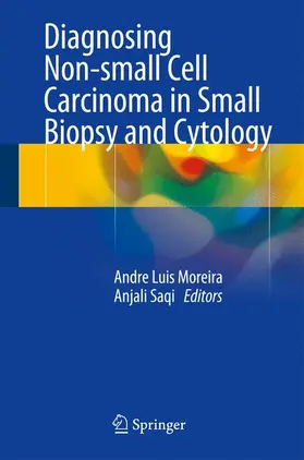 Moreira / Saqi | Diagnosing Non-Small Cell Carcinoma in Small Biopsy and Cytology | Buch | 978-1-4939-1606-1 | sack.de