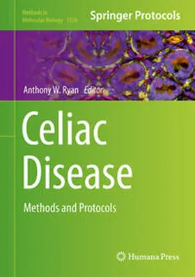 Ryan | Celiac Disease | E-Book | www2.sack.de