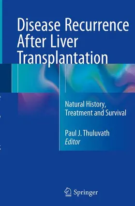 Thuluvath |  Disease Recurrence After Liver Transplantation | Buch |  Sack Fachmedien