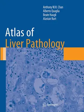 Chan / Burt / Quaglia |  Atlas of Liver Pathology | Buch |  Sack Fachmedien