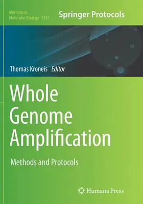 Kroneis |  Whole Genome Amplification | Buch |  Sack Fachmedien