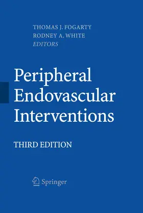 White / Fogarty |  Peripheral Endovascular Interventions | Buch |  Sack Fachmedien