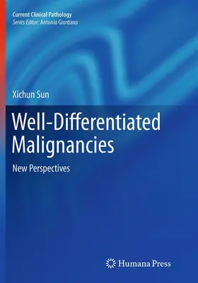 Sun |  Well-Differentiated Malignancies | Buch |  Sack Fachmedien