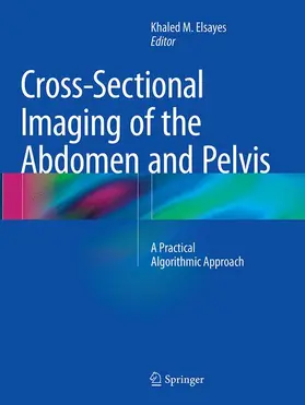 Elsayes |  Cross-Sectional Imaging of the Abdomen and Pelvis | Buch |  Sack Fachmedien