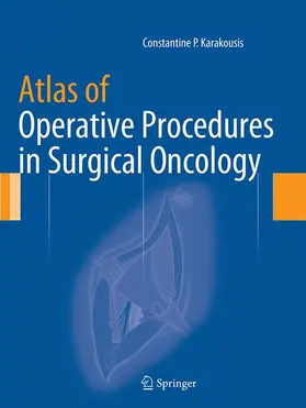 Karakousis |  Atlas of Operative Procedures in Surgical Oncology | Buch |  Sack Fachmedien