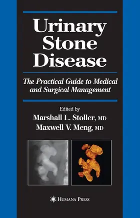 Meng / Stoller |  Urinary Stone Disease | Buch |  Sack Fachmedien