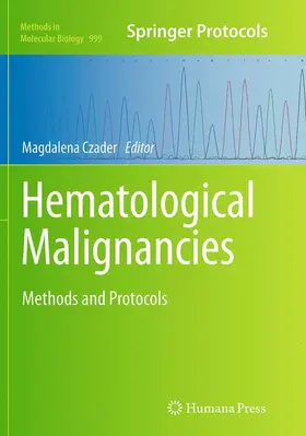 Czader |  Hematological Malignancies | Buch |  Sack Fachmedien