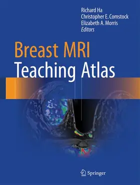 Ha / Comstock / Morris |  Breast MRI Teaching Atlas | Buch |  Sack Fachmedien