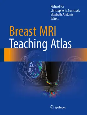Ha / Comstock / Morris |  Breast MRI Teaching Atlas | eBook | Sack Fachmedien