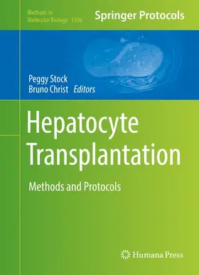 Christ / Stock |  Hepatocyte Transplantation | Buch |  Sack Fachmedien