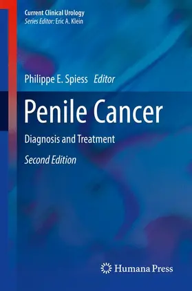 Spiess |  Penile Cancer | Buch |  Sack Fachmedien