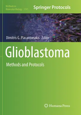 Placantonakis |  Glioblastoma | Buch |  Sack Fachmedien