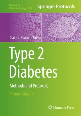 Stocker |  Type 2 Diabetes | Buch |  Sack Fachmedien