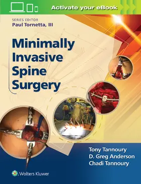 Tannoury |  Minimally Invasive Spine Surgery | Buch |  Sack Fachmedien