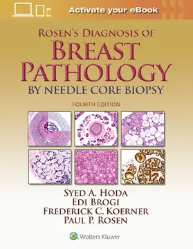 Hoda / Rosen / Brogi |  Rosen's Diagnosis of Breast Pathology by Needle Core Biopsy | Buch |  Sack Fachmedien