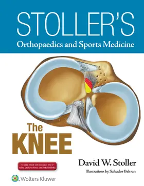 Stoller |  Stoller's Orthopaedics and Sports Medicine: The Knee | Buch |  Sack Fachmedien