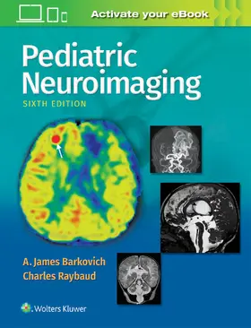 Barkovich / Raybaud |  Pediatric Neuroimaging | Buch |  Sack Fachmedien