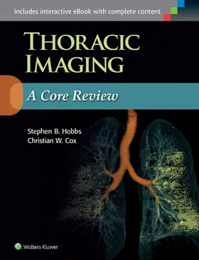 Hobbs / Cox | Thoracic Imaging: A Core Review | Buch | 978-1-4963-4748-0 | www2.sack.de