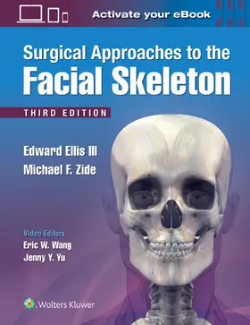 Ellis / Ellis, III / Zide |  Surgical Approaches to the Facial Skeleton | Buch |  Sack Fachmedien