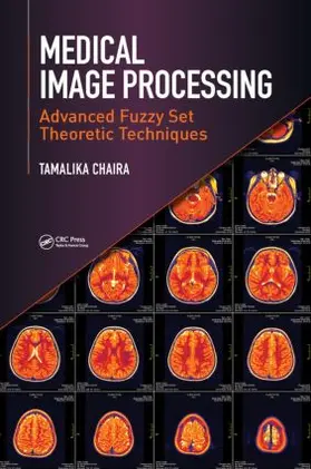 Chaira | Medical Image Processing | Buch | 978-1-4987-0045-0 | www2.sack.de