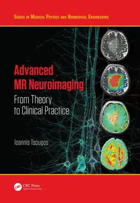 Tsougos |  Advanced MR Neuroimaging | Buch |  Sack Fachmedien