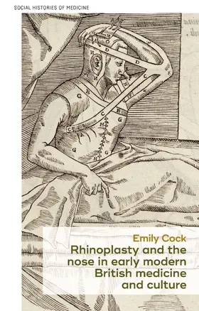 Cock |  Rhinoplasty and the nose in early modern British medicine and culture | eBook | Sack Fachmedien