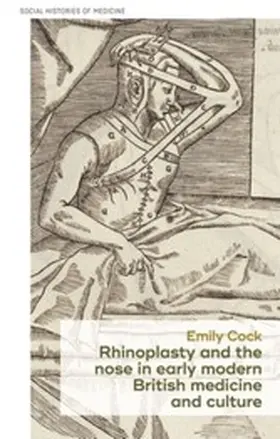 Cock |  Rhinoplasty and the nose in early modern British medicine and culture | eBook | Sack Fachmedien
