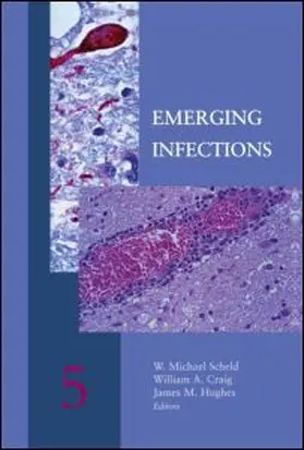 Scheld / Hughes / Craig |  Emerging Infections 5 | Buch |  Sack Fachmedien