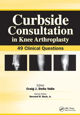 Della Valle |  Curbside Consultation in Knee Arthroplasty | Buch |  Sack Fachmedien