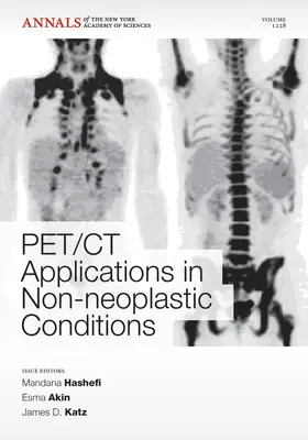 Hashefi / Akin / Katz |  Pet CT Applications in Non-Neoplastic Conditions, Volume 1228 | Buch |  Sack Fachmedien