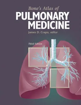 Crapo |  Bone's Atlas of Pulmonary Medicine | Buch |  Sack Fachmedien