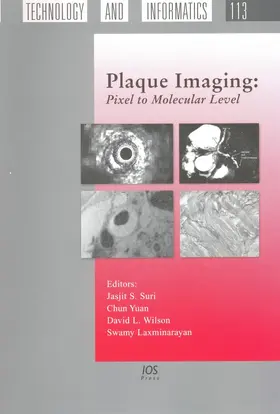 Yuan / Wilson / Laxminarayan |  Plaque Imaging | Buch |  Sack Fachmedien