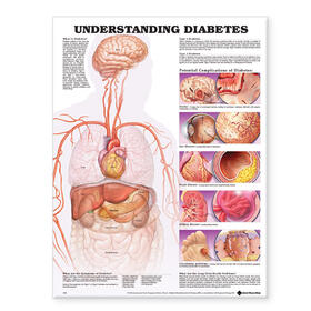  Understanding Diabetes Anatomical Chart | Sonstiges |  Sack Fachmedien