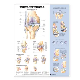  Knee Injuries Anatomical Chart | Sonstiges |  Sack Fachmedien