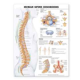  Human Spine Disorders Anatomical Chart | Sonstiges |  Sack Fachmedien