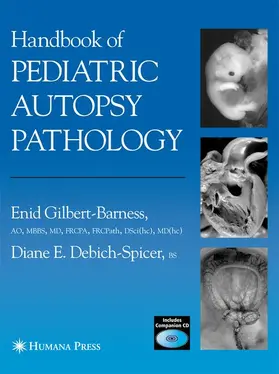 Gilbert-Barness / Debich-Spicer |  Handbook of Pediatric Autopsy Pathology | Buch |  Sack Fachmedien