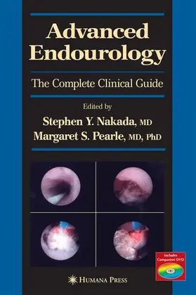 Pearle / Nakada |  Advanced Endourology | Buch |  Sack Fachmedien