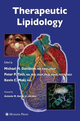 Davidson / Toth / Maki |  Therapeutic Lipidology | Buch |  Sack Fachmedien