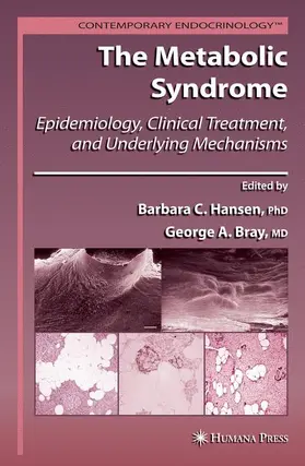 Bray / Hansen |  The Metabolic Syndrome: | Buch |  Sack Fachmedien