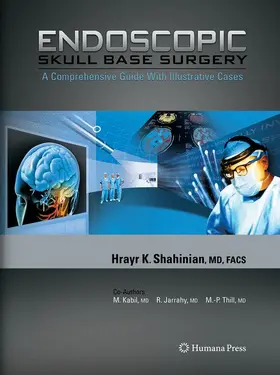 Shahinian |  Endoscopic Skull Base Surgery | Buch |  Sack Fachmedien