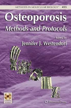 Westendorf |  Osteoporosis | Buch |  Sack Fachmedien